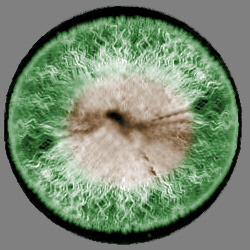 Eye-Template-3_den_250px-green_brownspot.jpg